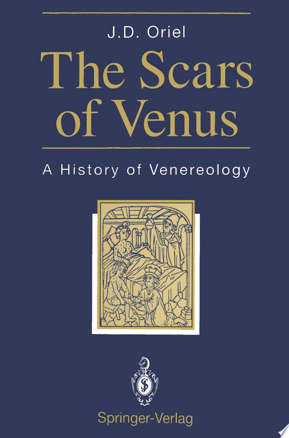 The Scars of Venus